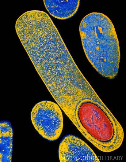 A Clostridium difficile infekció Spóra-képző, mozgó Obligát anaerob pálca Gram-pozitív A exotoxin (enterotoxikus) B exotoxin (cytotoxikus) Binary toxin -virulancia Adhezin, proteolytikus enzimek AB