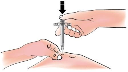A tű szürke kupakját levéve vezesse a fecskendőt a bőrbe 45 és 90 fokos szög között tartva a fecskendőt.