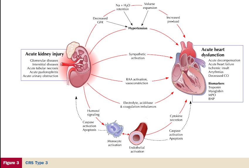 CRS-III: