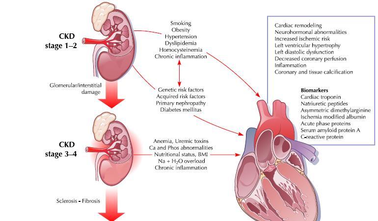 CRS-IV: