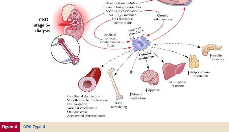 CRS-IV: