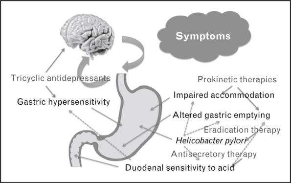 Dyspepsia.