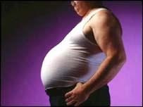 Az abdominális elhízás és a haskörfogat IDF (2005): Abdominális obesitas - Europid Derékkörf. (férfi) > 94 cm Derékkörf.