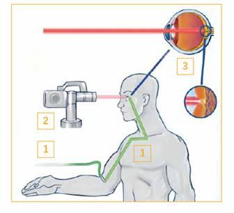 Visudyne -