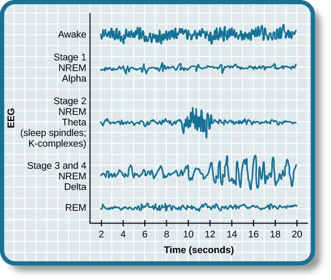 Objektív mérések Alvási orsók: talamusz és agykéreg interakciója (thalamo-cortical loop) Sch-ban: csökkent időtartam, sűrűség és amplitúdó (nem beteg rokonokban is!