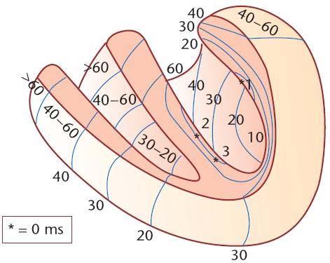 Szeptális Anterior Inferior Laterális Inferobazális Az inferobazális (4) rész aktiválódása 40-50 msec-ot késik élettanilag, ezért nekrózis esetén nem képezhet pathológiás Q hullámot vagy annak