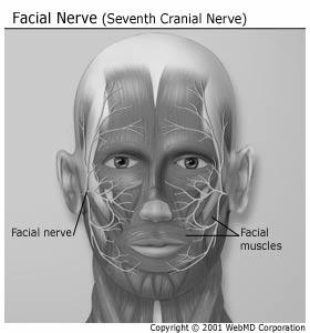 Centrális bénulás esetén a károsodással ellenkező oldalon a szájzug mozgása elmarad, a homlokát jól tudja a beteg ráncolni és a szemét is általában be tudja