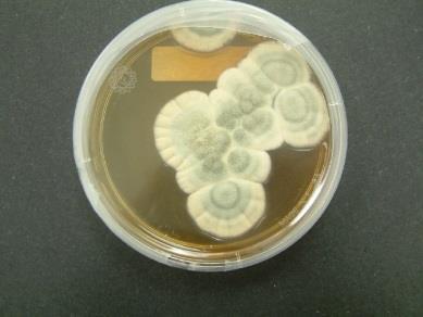 Bioszintézis L-amino-adipinsav L-Cys D-Val Ala-Cys-D-Val tripeptid Izopenicillin Kefalosporin Penicillin G Bioszintézis