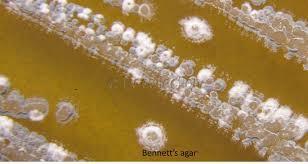 Streptomyces peucetius