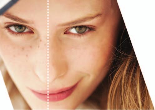 - 5% Ephelis Alpha Protect SPF50+krém 100g 2 093.- 18% Ephelis alpha gél 50g 1 884.- 18% Ephelis alpha gél 20g 937.