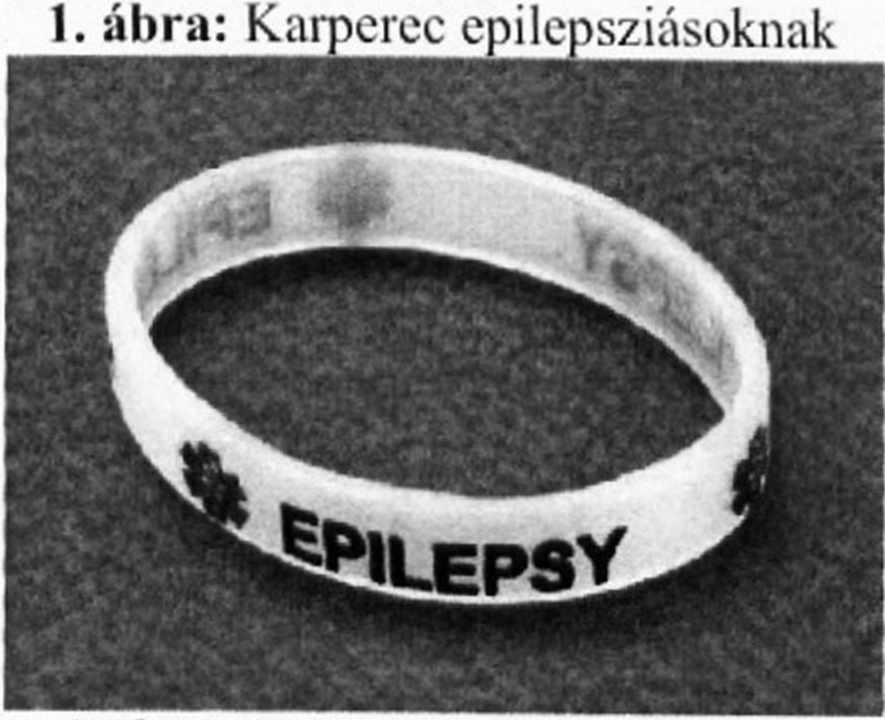 Az epilepsziáról általánosságban Forrás: http://\\'\\rw.epilepsziaegyesulet.5inp.eu Epilepszia Az epilepszia görög eredetű szó, jelentése fogva tartás vagy megragadás.