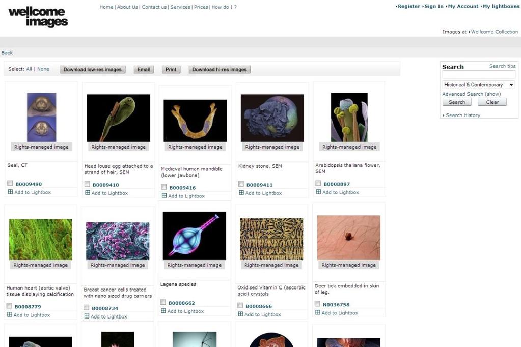 Wellcome Images CC BY vagy CC
