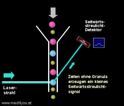 detector laser