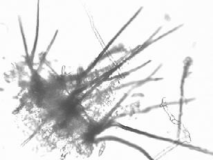 A gombafaj mikroszkopikus vizsgálatok során a merev, egyenes serteszőrökkel ellátott acervulusz telepeiről (9. ábra) és a tipikus, sarló alakú, olajcseppel ellátott konídiumairól (9C.