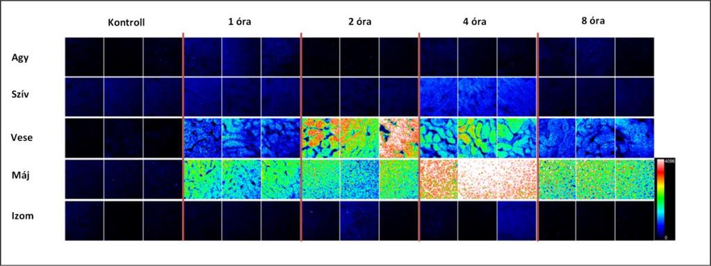 10. ábra. Az Ac-915 szöveti eloszlása. Az Ac-915 szöveti eloszlását fluoreszcens mikroszkóppal vizsgáltuk natív metszeteken, intravénás alkalmazás után. Minden kép 125x125 µm szövetrészt jelenít meg.