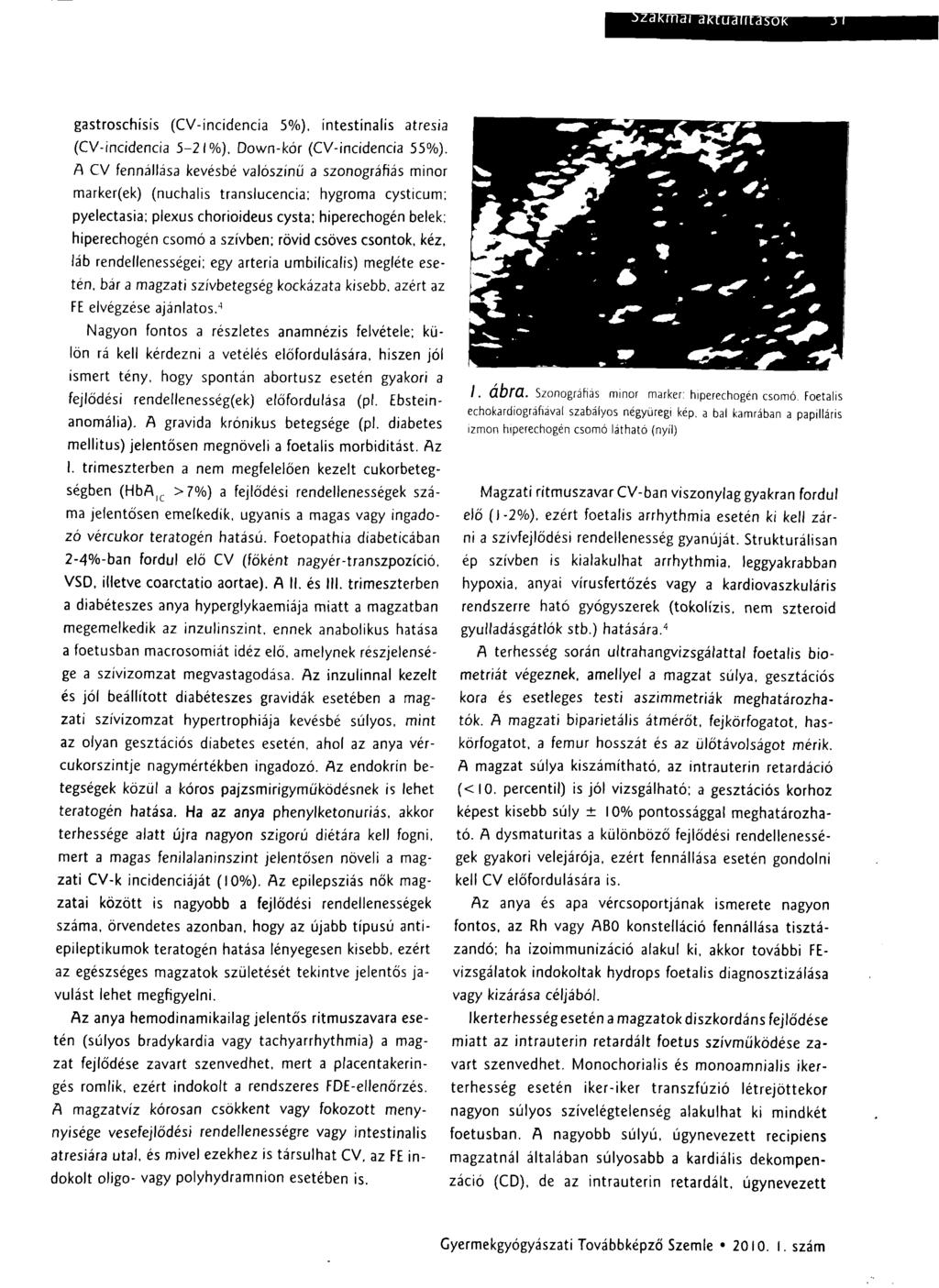 gastroschísis (CV-incidencia 5%), intestinalis atresia (CV-incidencia 5-21%), Down-kór (CV-incidencia 55%).