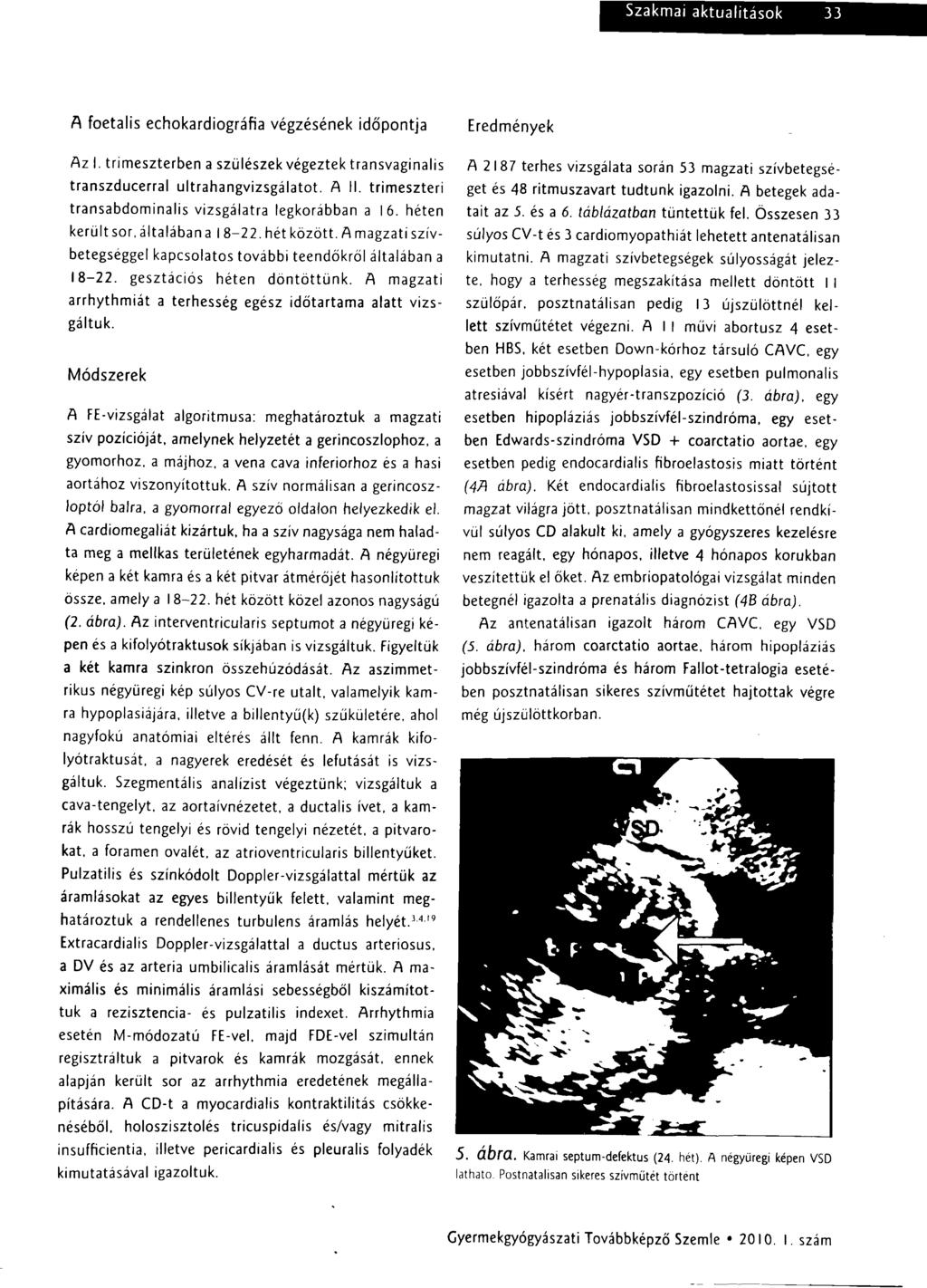 A foetalis echokardiográfia végzésének időpontja Az I. trimeszterben a szülészek végeztek transvaginalis transzducerral ultrahangvizsgálatot. A II.