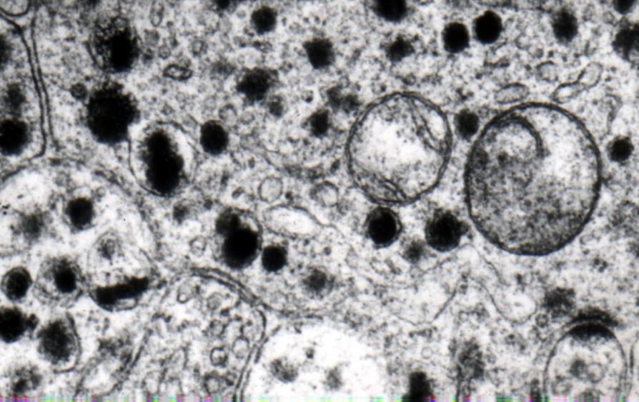 Neuroendokrin (APUD) sejtek Neurotransmitter, neuromodulátor vagy