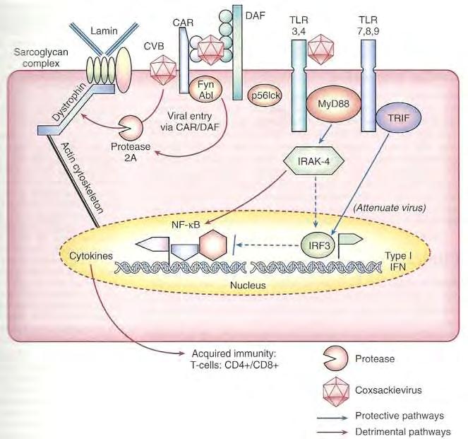 COXSACKIE B3 MYOCARDITIS