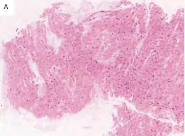 NORMALIS MYOCARDIUM myocyták
