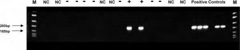 ENDOMYOCARDIALIS BIOPSZIA PCR
