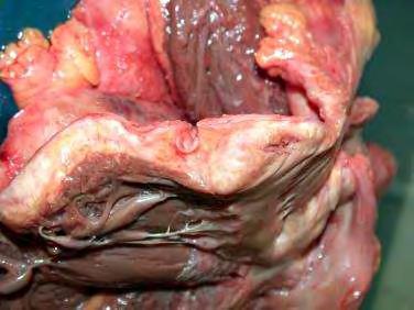 constrictiv pericarditis restrictiv cardiomyopathia echocardiographia,