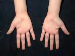 Rheumatol