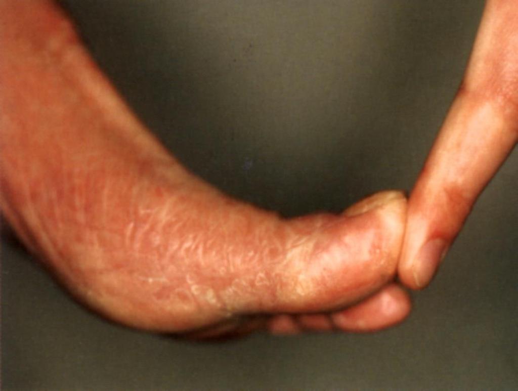 Limited joint mobility - öregujj Zick R.