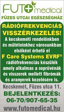 illetve rádiófrekvenciás tűvel is. A visszérbetegség kezelése komplex sebészeti feladat!