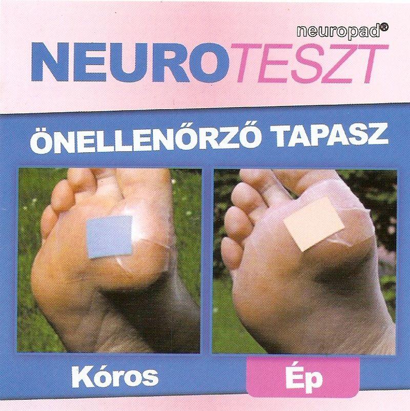 2.8. ábra: A sudomotor-zavar vizsgálata terén a neuroteszt (Neuropad) elterjedt.