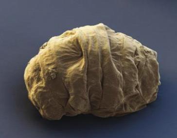 A baktérium a marsi körülmények között is egy lehetséges életforma. MEDVEÁLLATKA 7 A medveállatka (Tardigrade) az egyik legtűrőképesebb élőszervezet.
