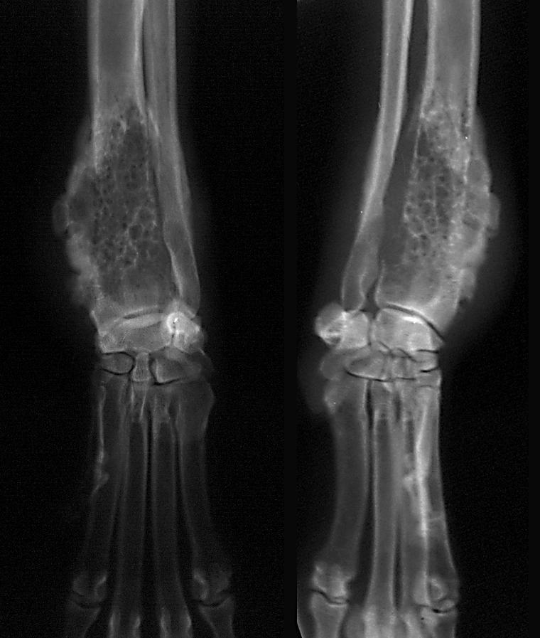 ) Az esetek 90%-a primer, azon belül 90% osteosarcoma Csontdaganatok terápiája lokalizáció: térd közel,