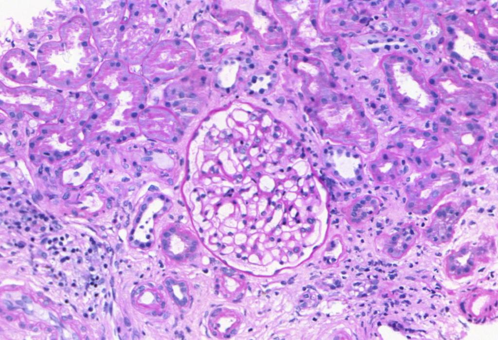 Glomerulus Ép