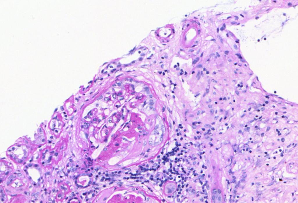 Glomerulus