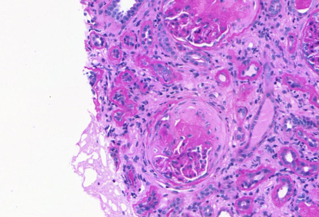 Glomerulus