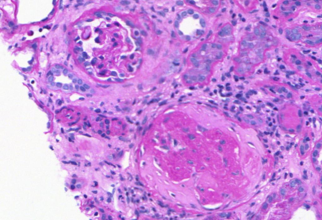 Glomerulus