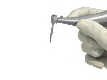 implantátum behajtót,