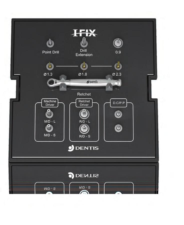 DENTIS Mini I-FIX KIT sebészeti készlet Sebészeti eszközök 0 04 0 0 03 05 06 07 09 08 Pontfúró Kézi menetfúró behajtó Részletek 0 DPD mm mm 0 Fúró hosszabbító DDE 08 09 Rövid ú mm 7mm DMRS DMRL Fúrók