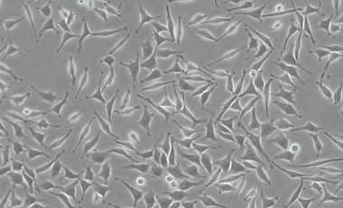 A citotoxicitási teszt eredménye ISO 0993-5-nek megfelelően a