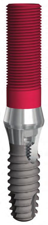 A Cleanlant implantátumrendszer előnyei Internal Fixture.0 mm Megmunkált nyak 0 4 0 03 5,000 A A R0.65 0.mm 0.