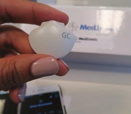 Helyette a jobb, de sokkal bonyolultabb Medtronic Guardian Connect valósidejű és az egyszerűbb, de csupán utólag kiértékelhető Medtronic ipro2 professzionális rendszer használható.