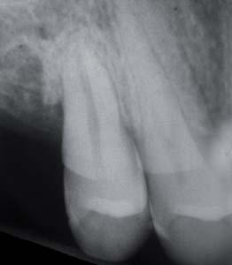 Angelo Fassi Orvostudományból doktorált a Milánói Egyetemen. A végzést követően érdeklődése a konzerváló fogászat és az endodoncia felé irányult. A San Raffaele Kórház Prof.