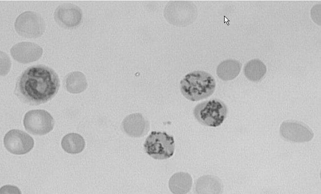 Vörösvérsejtek fejlődése Pluripotens őssejt Csontvelő vér Retikulocyta Erythrocyta Erythropoetin érzékenység Hemoglobin