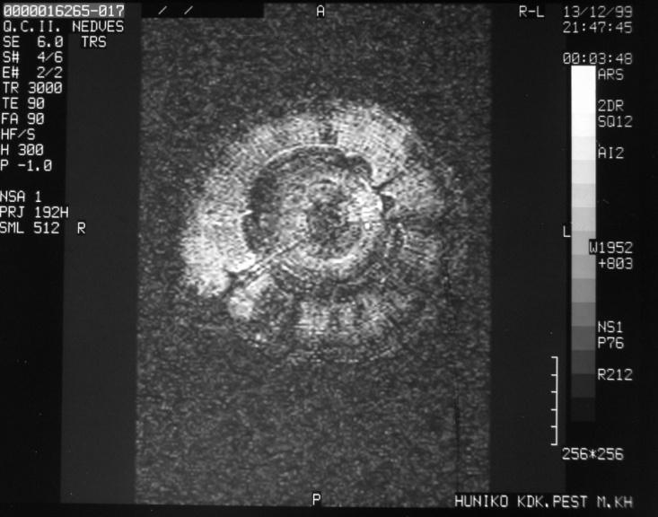 A Quercus pubescens szabad víztartalma hasonló a Quercus petraea-hoz,