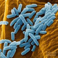 aeruginosa az MSZ 13690-3:1989 szerint is alap vizsgálati paraméter MSZ 152354:2012: