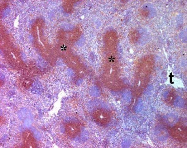 Lép, fehér pulpa Nyiroktüsző Periarterioláris limfoid hüvely (PALS: T sejt zóna)