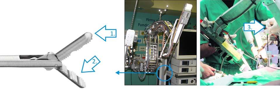 21 3D TAPINTÁSÉRZÉKELÉS ROBOTOKBAN Minimálisan Invazív Műtéti (MIS)