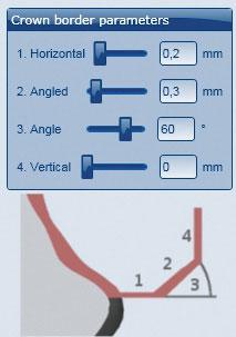 ALKALMAZÁS A szélekre vonatkozó paraméterek a CAD-szoftverben A Ceramill Zolid Preshades esetén ügyeljen arra, hogy a szélek vastagsága elég nagy legyen. A javasolt értékek a következők: _ 1.