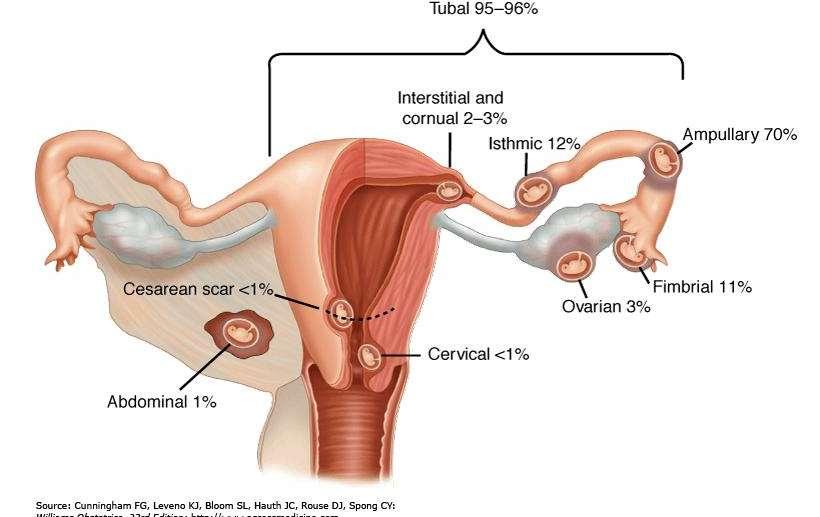 Az ondó kémhatása lúgos (prosztata), amely kedvez a spermiumok mozgásának, azonban a hüvely savas váladéka gátolja azt, ugyanakkor hatására az ondófolyadék besűrűsödik, ami meggátolja a női
