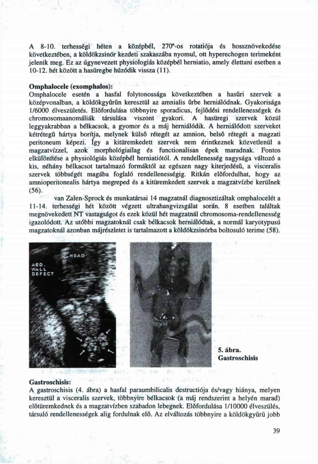 A 8-0, terhességi héten a középbél, 70 -s rtatiója és hssznövekedése következtében, a köldökzsinór kezdeti szakaszába nymul, tt hyperechgen tériméként jelenik meg.